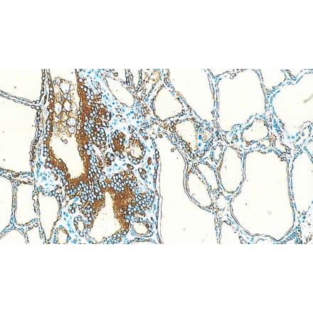 Immunohistochemistry - Anti-Thyroglobulin Antibody [1D4] (A320609) - Antibodies.com