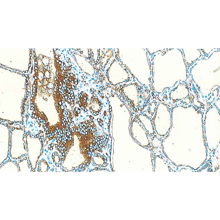 Immunohistochemistry - Anti-Thyroglobulin Antibody [1D4] (A320609) - Antibodies.com