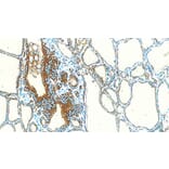 Immunohistochemistry - Anti-Thyroglobulin Antibody [1D4] (A320609) - Antibodies.com
