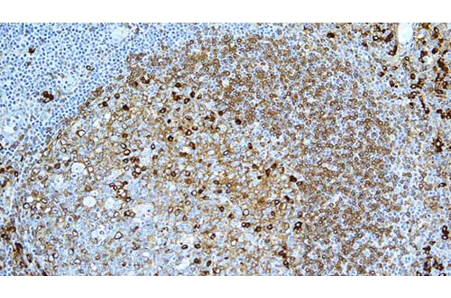 Immunohistochemistry - Anti-Kappa Light Chain Antibody [CH15] (A320611) - Antibodies.com