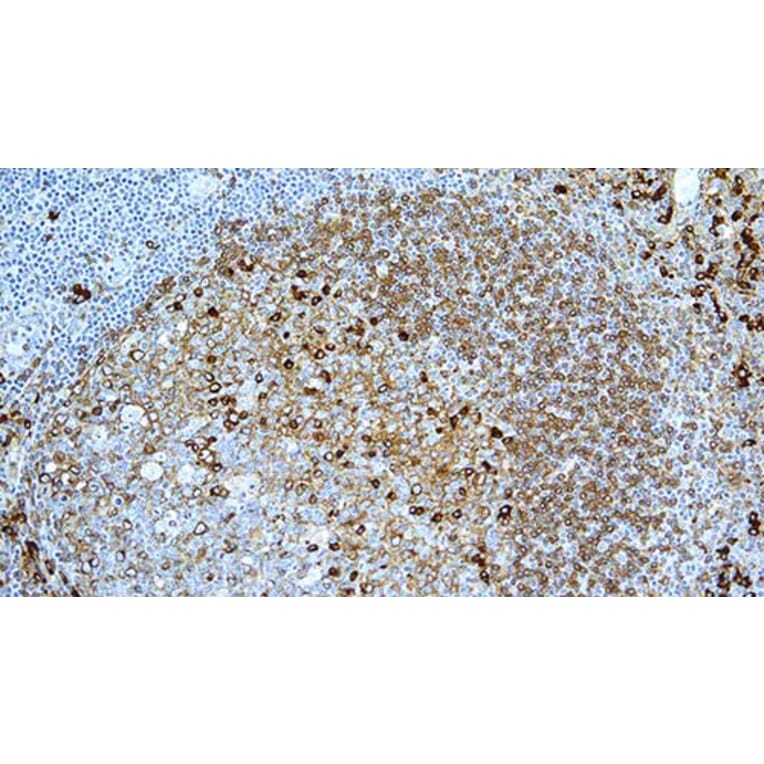 Immunohistochemistry - Anti-Kappa Light Chain Antibody [CH15] (A320611) - Antibodies.com