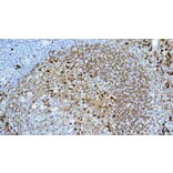 Immunohistochemistry - Anti-Kappa Light Chain Antibody [CH15] (A320611) - Antibodies.com