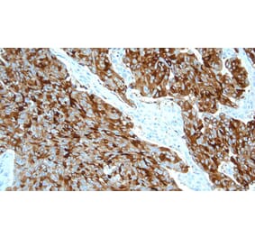 Immunohistochemistry - Anti-Calcitonin Antibody [CL1948] (A320612) - Antibodies.com