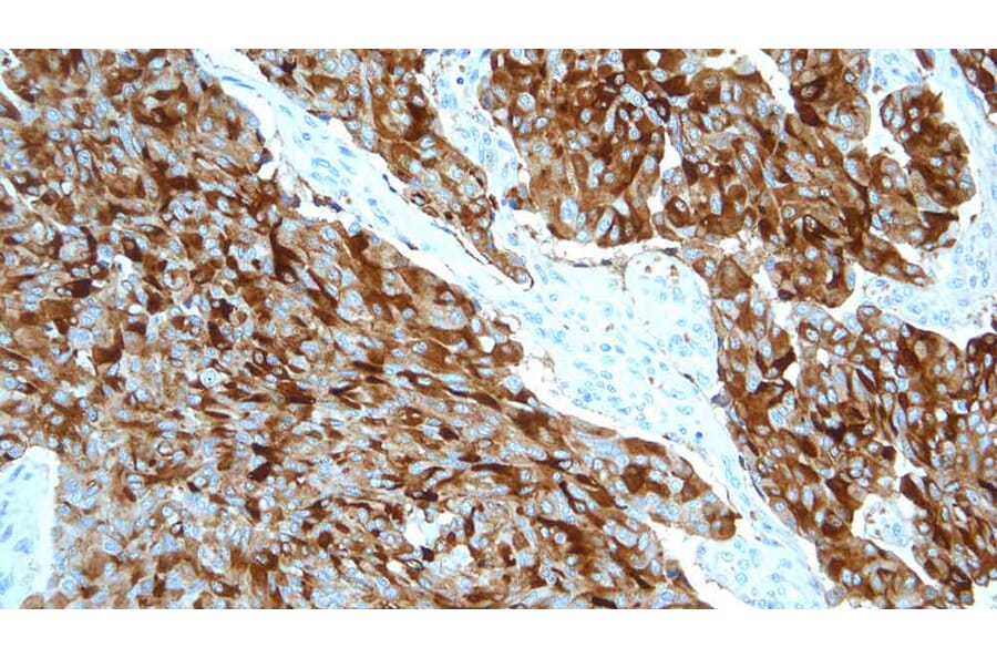 Immunohistochemistry - Anti-Calcitonin Antibody [CL1948] (A320612) - Antibodies.com