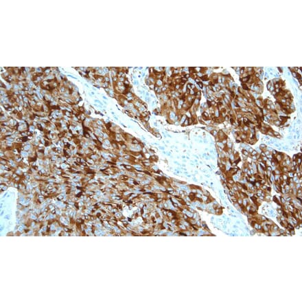 Immunohistochemistry - Anti-Calcitonin Antibody [CL1948] (A320612) - Antibodies.com