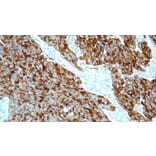 Immunohistochemistry - Anti-Calcitonin Antibody [CL1948] (A320612) - Antibodies.com