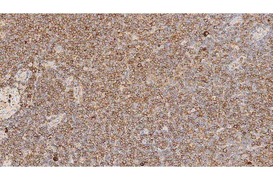 Immunohistochemistry - Anti-Lambda Light Chain Antibody [SHL53] (A320613) - Antibodies.com