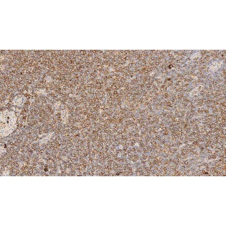Immunohistochemistry - Anti-Lambda Light Chain Antibody [SHL53] (A320613) - Antibodies.com