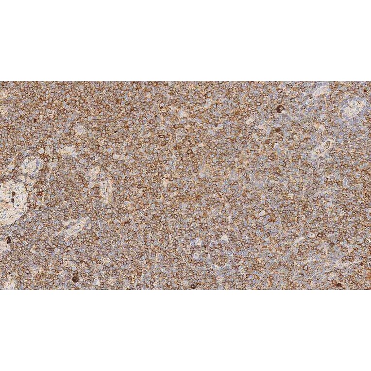 Immunohistochemistry - Anti-Lambda Light Chain Antibody [SHL53] (A320613) - Antibodies.com