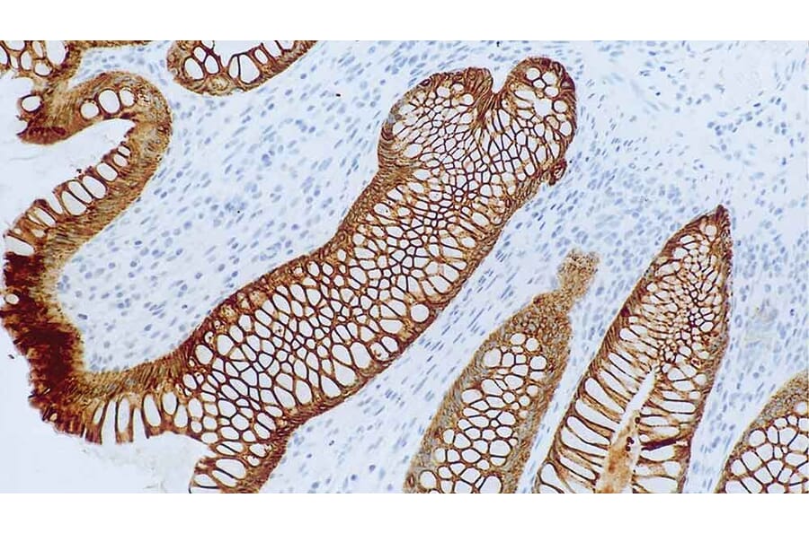 Immunohistochemistry - Anti-Cytokeratin 8 + 18 Antibody [5D3] (A320614) - Antibodies.com