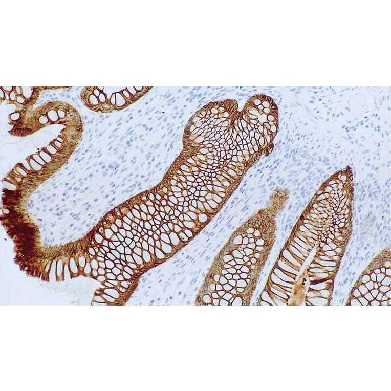Immunohistochemistry - Anti-Cytokeratin 8 + 18 Antibody [5D3] (A320614) - Antibodies.com