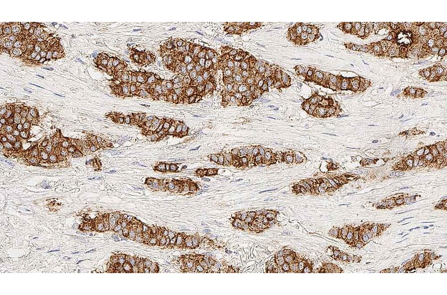 Immunohistochemistry - Anti-MUC1 Antibody [GP1.4] (A320615) - Antibodies.com
