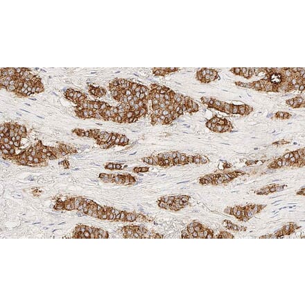 Immunohistochemistry - Anti-MUC1 Antibody [GP1.4] (A320615) - Antibodies.com