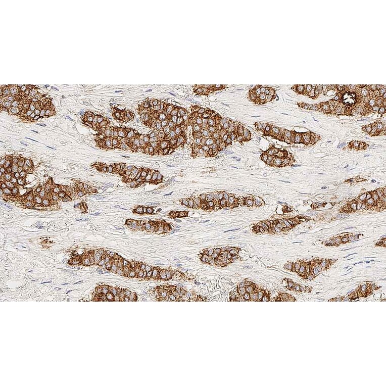 Immunohistochemistry - Anti-MUC1 Antibody [GP1.4] (A320615) - Antibodies.com