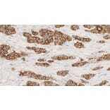 Immunohistochemistry - Anti-MUC1 Antibody [GP1.4] (A320615) - Antibodies.com