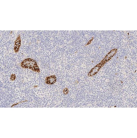 Immunohistochemistry - Anti-Von Willebrand Factor Antibody [36B11] (A320616) - Antibodies.com