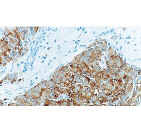 Immunohistochemistry - Anti-Synaptophysin Antibody [27G12] (A320617) - Antibodies.com