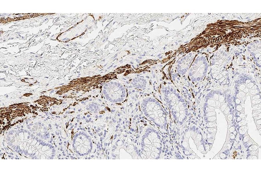 Immunohistochemistry - Anti-Desmin Antibody [DE-R-11] (A320618) - Antibodies.com