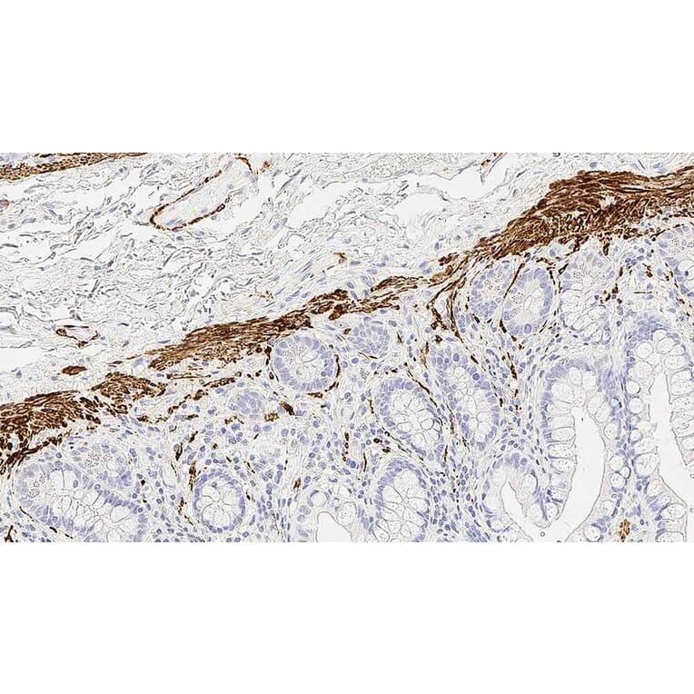 Immunohistochemistry - Anti-Desmin Antibody [DE-R-11] (A320618) - Antibodies.com