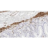 Immunohistochemistry - Anti-Desmin Antibody [DE-R-11] (A320618) - Antibodies.com