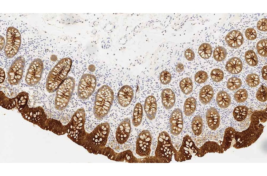 Immunohistochemistry - Anti-Carcinoembryonic Antigen Antibody [12-140-10] (A320619) - Antibodies.com