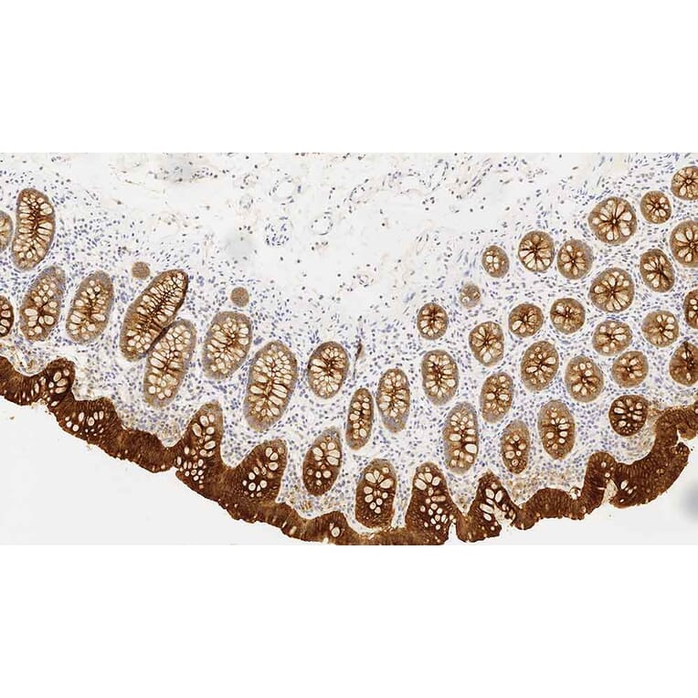 Immunohistochemistry - Anti-Carcinoembryonic Antigen Antibody [12-140-10] (A320619) - Antibodies.com