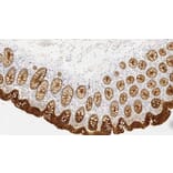 Immunohistochemistry - Anti-Carcinoembryonic Antigen Antibody [12-140-10] (A320619) - Antibodies.com