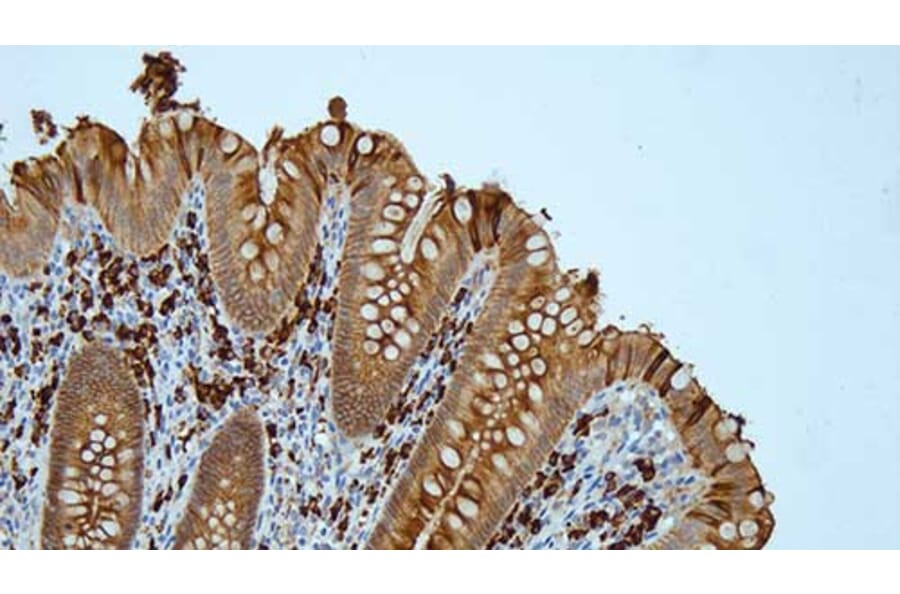 Immunohistochemistry - Anti-Human IgA Antibody [N1CLA] (A320620) - Antibodies.com