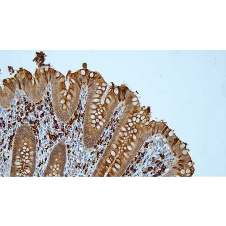 Immunohistochemistry - Anti-Human IgA Antibody [N1CLA] (A320620) - Antibodies.com