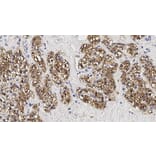 Immunohistochemistry - Anti-Parathyroid Hormone Antibody [105G7] (A320621) - Antibodies.com