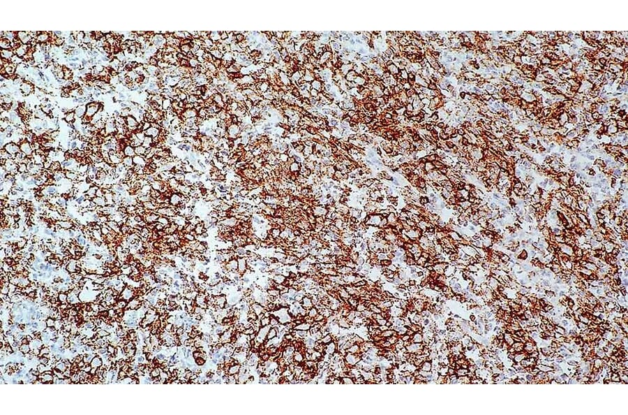 Immunohistochemistry - Anti-CD43 Antibody [MT1] (A320622) - Antibodies.com