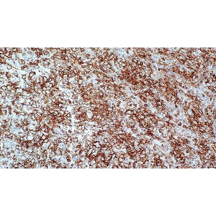 Immunohistochemistry - Anti-CD43 Antibody [MT1] (A320622) - Antibodies.com