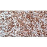 Immunohistochemistry - Anti-CD43 Antibody [MT1] (A320622) - Antibodies.com