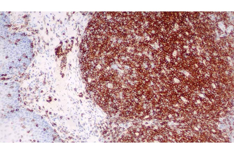 Immunohistochemistry - Anti-CD45 Antibody [X16/99] (A320623) - Antibodies.com