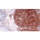 Immunohistochemistry - Anti-CD45 Antibody [X16/99] (A320623) - Antibodies.com