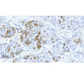 Immunohistochemistry - Anti-Cytokeratin 14 Antibody [LL002] (A320624) - Antibodies.com