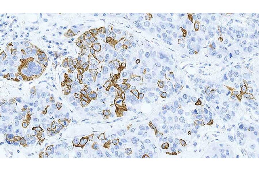 Immunohistochemistry - Anti-Cytokeratin 14 Antibody [LL002] (A320624) - Antibodies.com