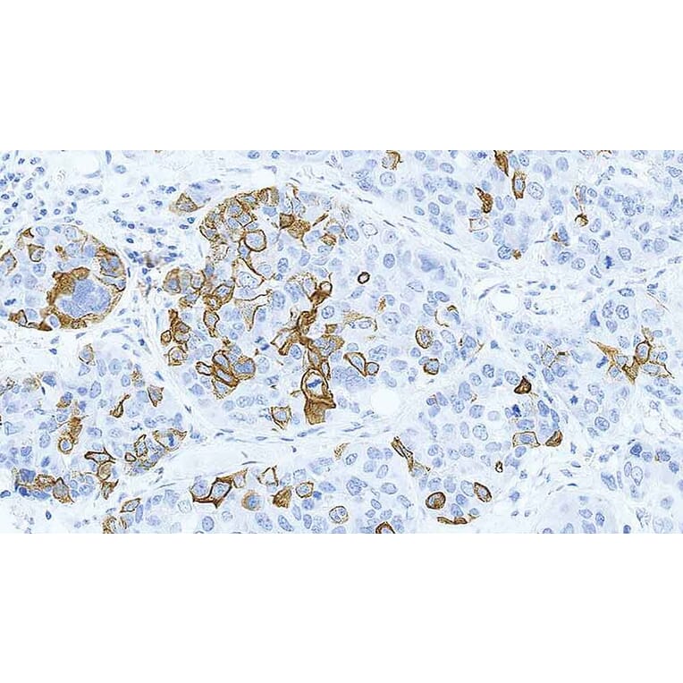 Immunohistochemistry - Anti-Cytokeratin 14 Antibody [LL002] (A320624) - Antibodies.com