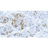 Immunohistochemistry - Anti-Cytokeratin 14 Antibody [LL002] (A320624) - Antibodies.com