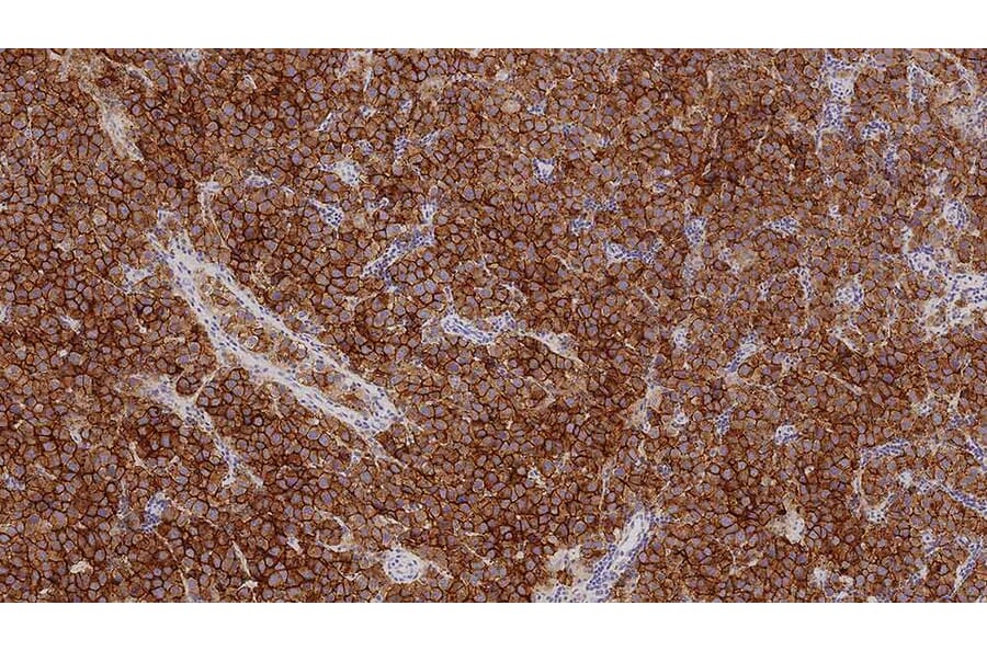 Immunohistochemistry - Anti-Placental Alkaline Phosphatase Antibody [8A9] (A320625) - Antibodies.com