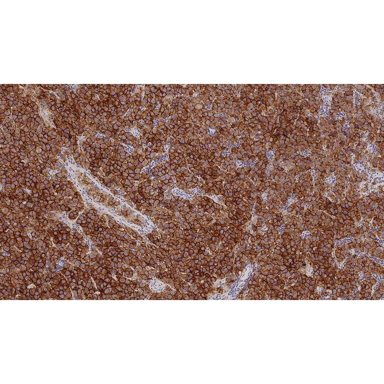 Immunohistochemistry - Anti-Placental Alkaline Phosphatase Antibody [8A9] (A320625) - Antibodies.com