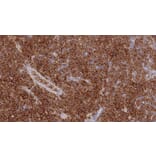 Immunohistochemistry - Anti-Placental Alkaline Phosphatase Antibody [8A9] (A320625) - Antibodies.com