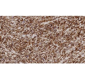 Immunohistochemistry - Anti-Vimentin Antibody [V9] (A320626) - Antibodies.com