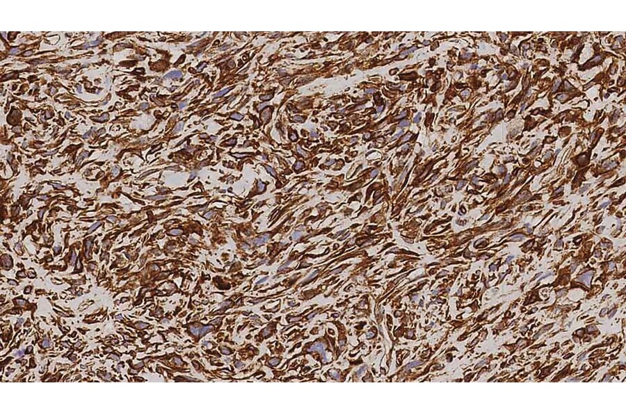 Immunohistochemistry - Anti-Vimentin Antibody [V9] (A320626) - Antibodies.com
