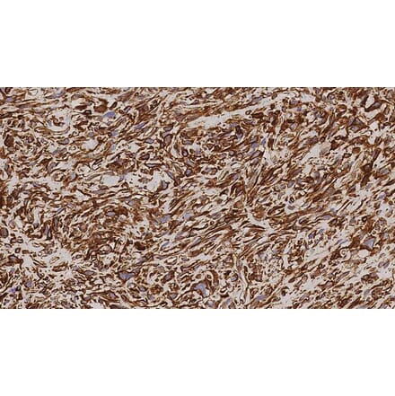 Immunohistochemistry - Anti-Vimentin Antibody [V9] (A320626) - Antibodies.com