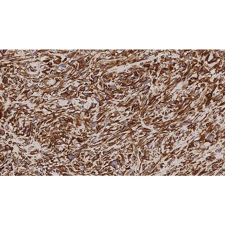 Immunohistochemistry - Anti-Vimentin Antibody [V9] (A320626) - Antibodies.com