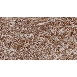 Immunohistochemistry - Anti-Vimentin Antibody [V9] (A320626) - Antibodies.com