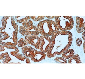 Immunohistochemistry - Anti-PAP Antibody [PASE/4LJ] (A320629) - Antibodies.com