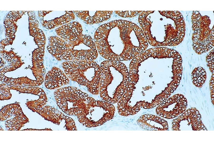 Immunohistochemistry - Anti-PAP Antibody [PASE/4LJ] (A320629) - Antibodies.com