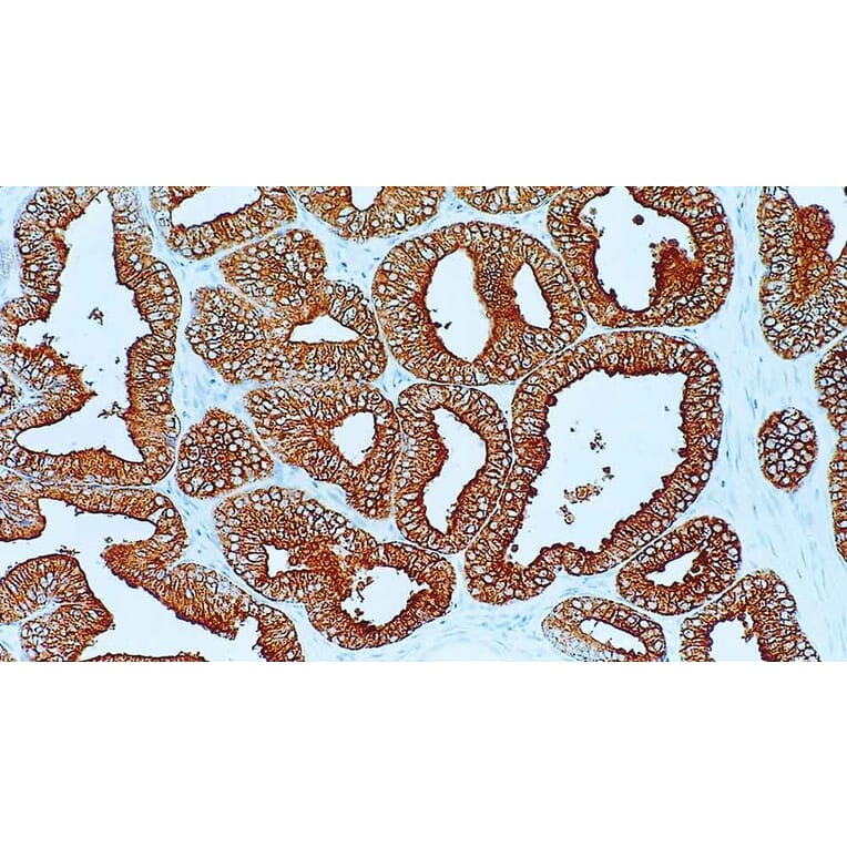 Immunohistochemistry - Anti-PAP Antibody [PASE/4LJ] (A320629) - Antibodies.com
